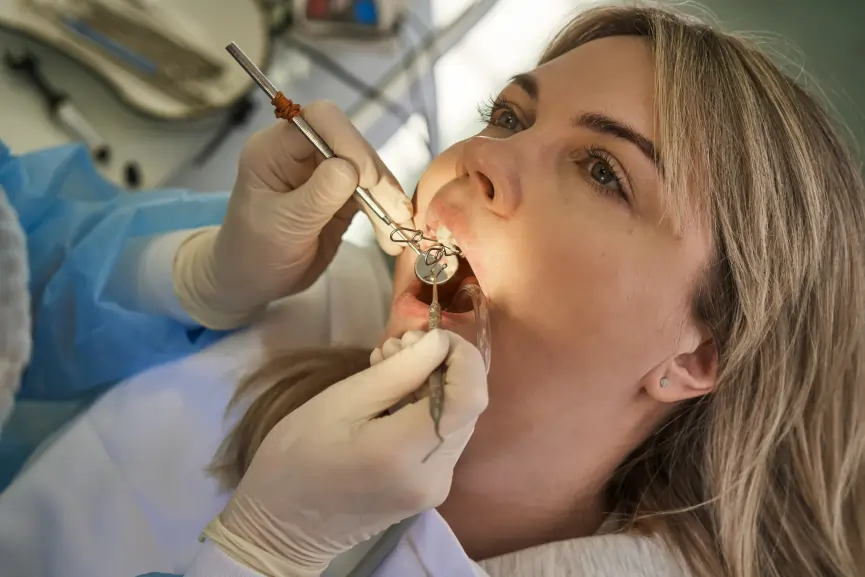 Tooth Extractions in Grimsby