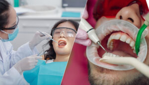 Dental Checkup vs Dental Cleaning