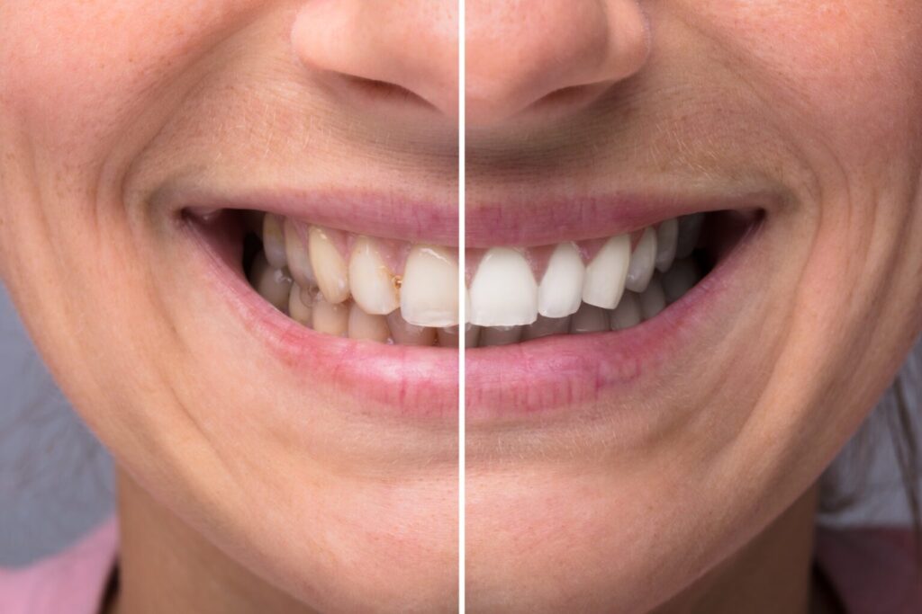 How Cosmetic Dentistry Can Transform Your Smile