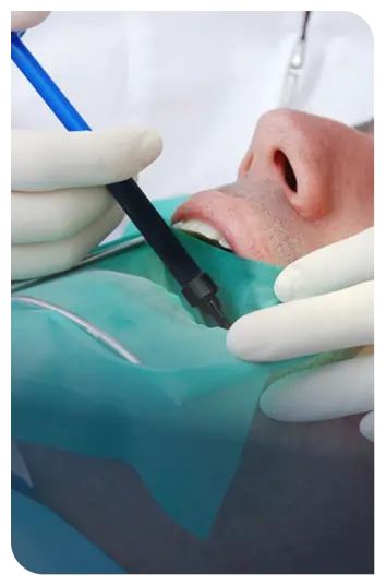 Root Canal Therapy